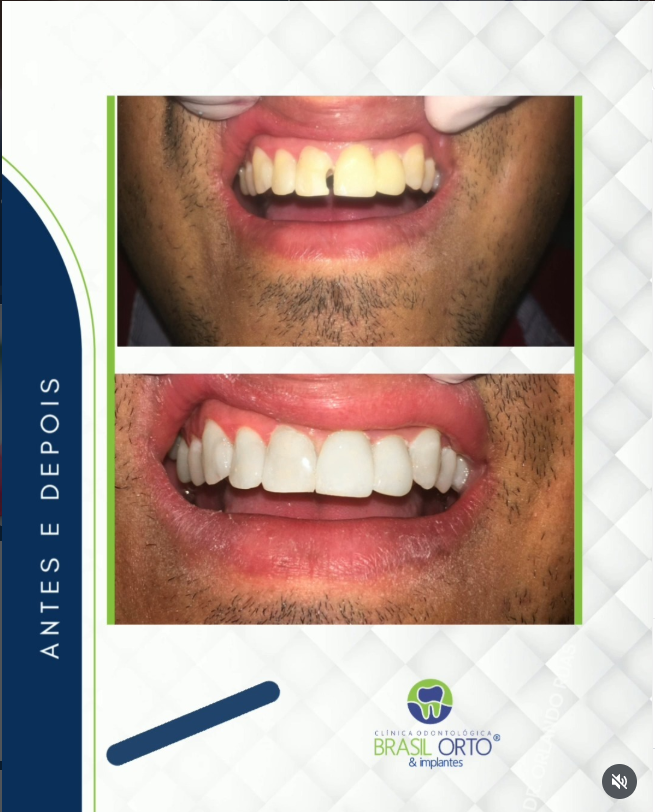 Brasil Orto & Implantes